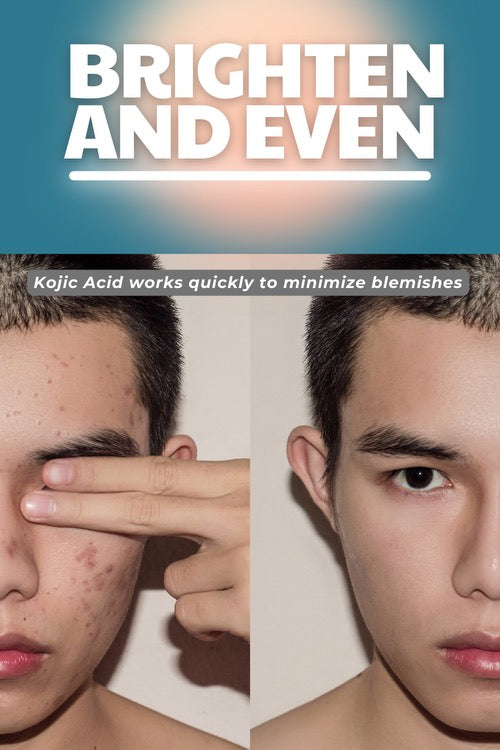 Brightening Cream w/Kojic Acid